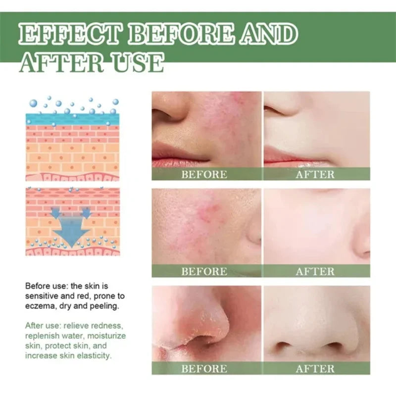 Facial Redness Repair Cream Improve Sensitive Skin Dryness Hydrating Sooth Lotion Removal Rosacea Day Night Korean Cosmetics