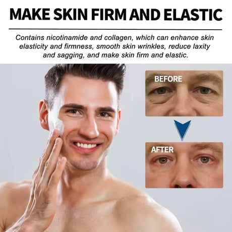 Retinol Eye Bag Removal Cream For Men Anti-Wrinkle Firming Skin Fades Fine Lines Anti Dark Circle Puffiness Brightening Eye Care