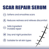EELHOE Silicone Skin Scar Gel Retinol Niacinamide Scars Stretch Marks Burn Marks Deeply Nourish Skin Reduce Redness Swelling 30g