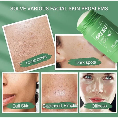 Original Facial Remove Blackhead Green Tea Solid Mask Treat Acne Blemish Black Dots Clean Stick Cream Shrink Pores Skin Care