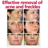 Whitening Freckle Cream Effectively reduces dark spots Brightens and revitalizes dull skin  Hydrates and nourishes the skin