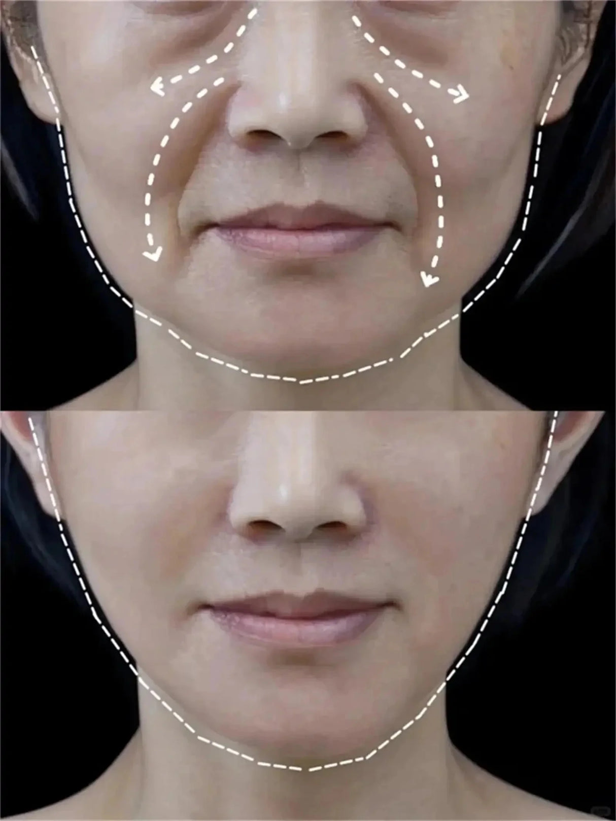 Blue Copper Peptide Wrinkle Remover Serum Instant Firming Lifting Anti-Aging Fade Fine Lines Whitening Korean Skin Care Products