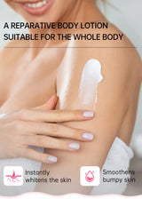 Chicken Skin Removal Cream Body Curing Keratosis Follicle Pore Spot Dull Treatment Whitening Moisturizing Body Care JoyPretty