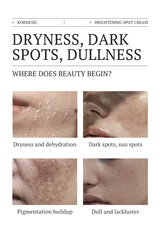 Dark Spots Removal Cream Facial Whitening Freckle Acne Mark Pigmentation Removal Melanin Skin Correction Brighten Care Products