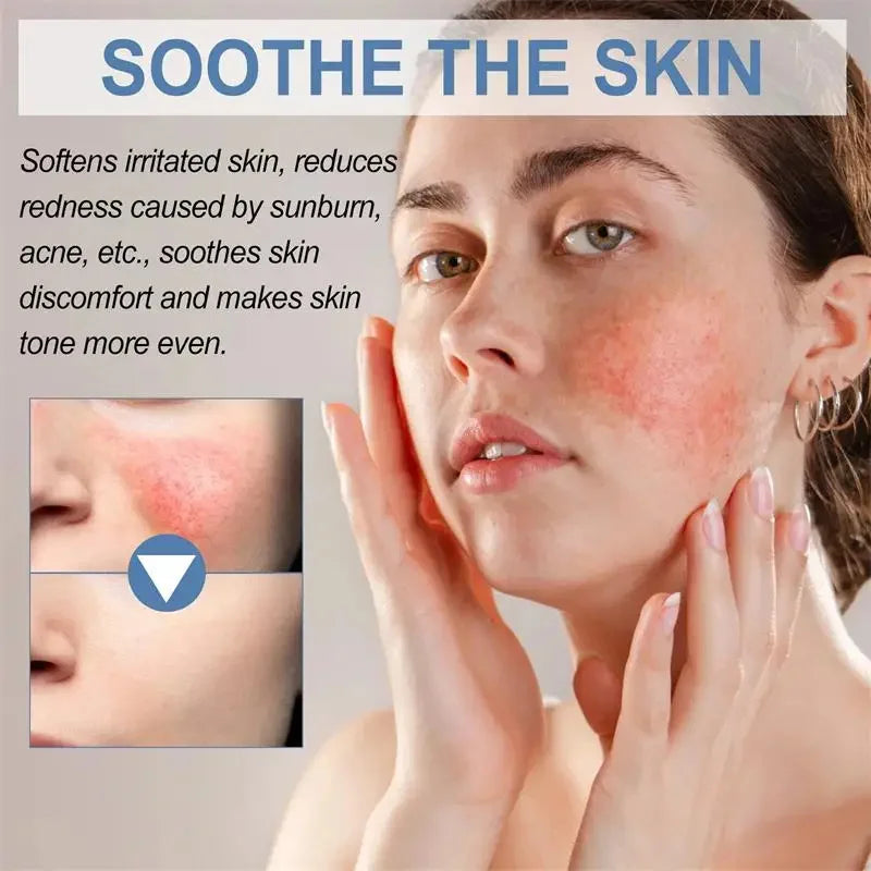 Instant Facial Redness Repair Cream Soothing Red Blood Rosacea Treatment Improve Sensitive Skin Anti Redness Skin Care Cosmetics