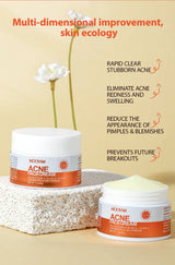 Herbal Acne Treatment Cream Anti Acne Face Cream Pimple Removal Spots Oil Control Shrink Pores Moisturizing Skin Care Cream