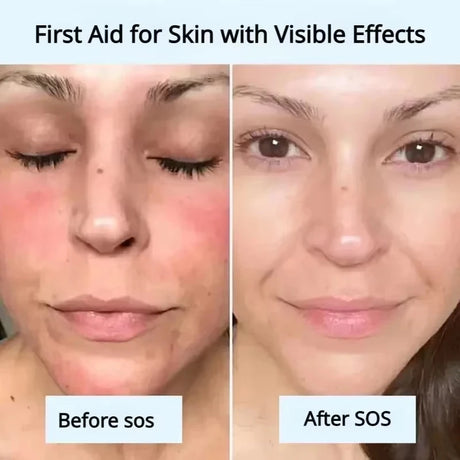B5 Repair Cream Moisturizing Hydrating Effectively Solves Dry Chapped And Red Skin Nourishes Improve Repair Sunscreen Cream