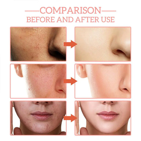 5 In 1 Hyaluronic Acid Face Serum Moisturizing Vitamin C collagen Lightning Facial Serum Shrink Pores Skin Care