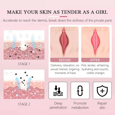 Body Whitening Cream Private Parts Bleach Arm Knees Lip Dark Skin Brighten Melanin Intimate Area Pink Essence Moisturizing Care
