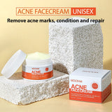 Herbal Acne Treatment Cream Anti Acne Face Cream Pimple Removal Spots Oil Control Shrink Pores Moisturizing Skin Care Cream