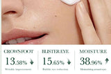SADOER Tea Tree Acne Removing Face Cream Anti Acne Hydrating Oil Control Moisturizing Facial Creams Face Skin Care Products