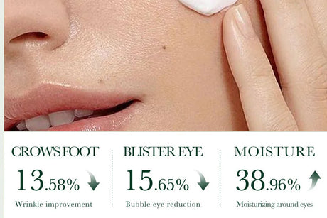 SADOER Tea Tree Acne Removing Face Cream Anti Acne Hydrating Oil Control Moisturizing Facial Creams Face Skin Care Products