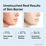 Facial Redness Repair Cream Improve Sensitive Skin Dryness Moisturizer Hydrating Sooth Lotion Removal Rosacea Korean Cosmetics