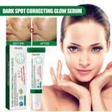 Dark Spot Correcting Glow Serum,Dullness,Acne,And Melanin Remover,Niacinamide Facial Skin Moisturizing Brightening Skincare