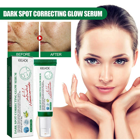 Dark Spot Correcting Glow Serum,Dullness,Acne,And Melanin Remover,Niacinamide Facial Skin Moisturizing Brightening Skincare