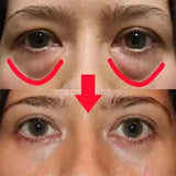 Caviar Eye Bag Removal Cream Hyaluronic Acid Anti-Wrinkle Firming Skin Fade Fine Lines Anti Dark Circle Puffiness Eye Care 20g