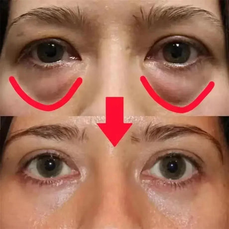 Caviar Eye Bag Removal Cream Hyaluronic Acid Anti-Wrinkle Firming Skin Fade Fine Lines Anti Dark Circle Puffiness Eye Care 20g