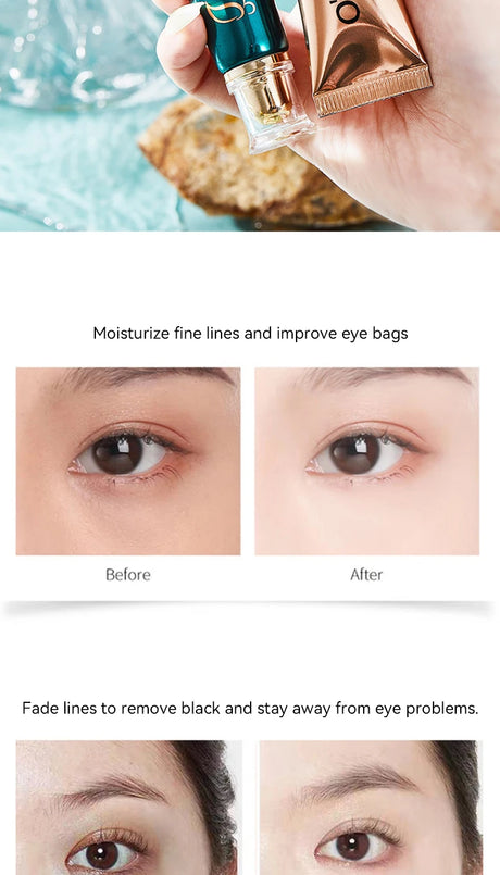 Ouqianya Retinol Eye Cream Moisturizing Firming Dark Circle Care Fine Line Treatment Anti-Wrinkle Daily Use,Under Eye Care