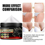 TRSTAY Stretch Mark Cream for Pregnancy Skin Replenish And Repair Cell Growth Promotion Maternity Striae Gravidarum Care