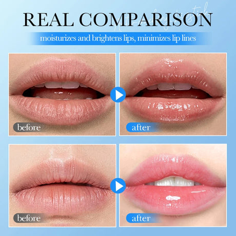 SADOER 1/5/10/15/20PCS Hyaluronic Acid Lip Balm Long-Lasting Moisturizing Lip Care, Hydrating & Nourishing Soothe Dryness