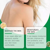 Hanchobit Cactus Soothing Gel Sunburn Treatment Relief Redness After Sun Cool Moisturizing Skin Barrier Repair Calming Gel Cream