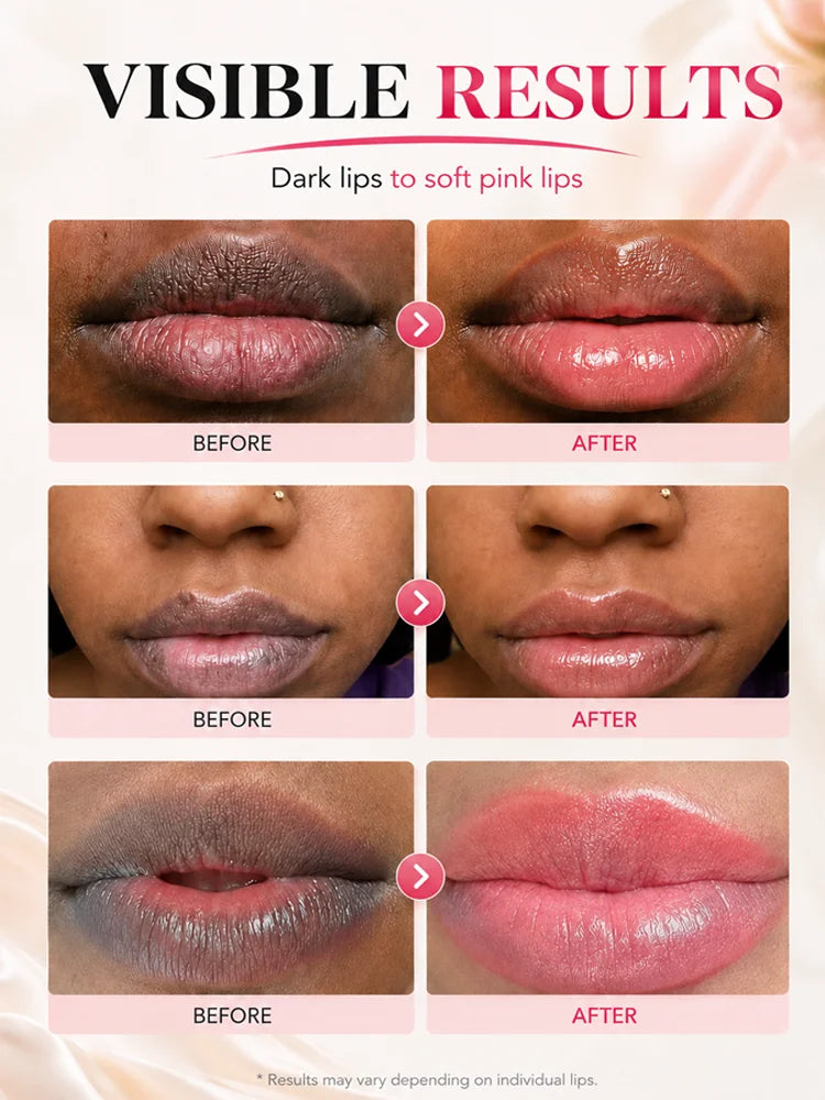 Lighten & Repair Dark Lips Lip Balm Reduce Lip Pigment Deposition Exfoliate Hydrating Lip Treatment