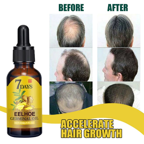 EELHOE 20ml Ginger Hair Growth Oil Strengthening Scalp Nourishing Hair Roots Anti Loss Fuller Care Hairs Essence for Women Men
