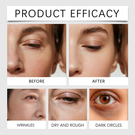 Eye-Lift Calcium Patches Instant Volume Boost & Brightening,Refreshing Hydrogel Mask for Tired Eye,Vegan & Cruelty-Free Skincare