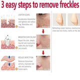 Whitening Freckle Cream Effectively reduces dark spots Brightens and revitalizes dull skin  Hydrates and nourishes the skin