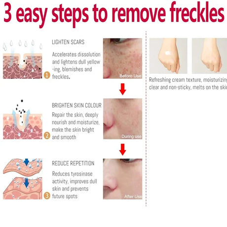 Whitening Freckle Cream Effectively reduces dark spots Brightens and revitalizes dull skin  Hydrates and nourishes the skin