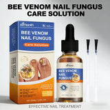 Nail Fungus Care Solution Anti-Infection Onychomycosis Repair Damaged Cracked Hand Foot Nail Manicureed Health Care Essence 50ml