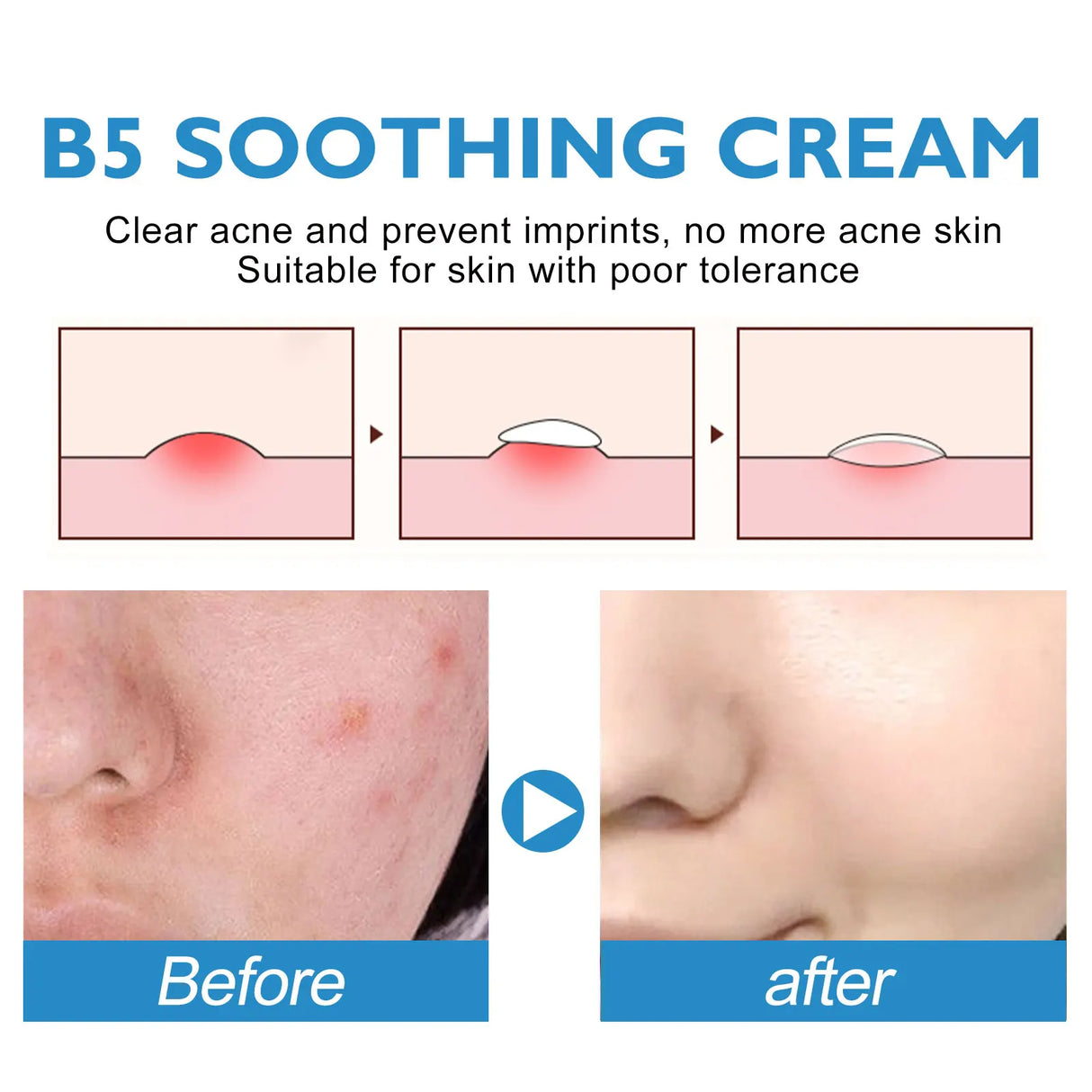 B5 Repair Cream Moisturizing Hydrating Soothing Dry Chapped Redness Skin Nourishes Hydrating Barrier Support Beauty Face Cream