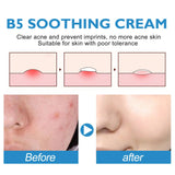 B5 Repair Cream Moisturizing Hydrating Soothing Dry Chapped Redness Skin Nourishes Hydrating Barrier Support Beauty Face Cream