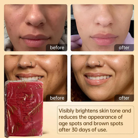 Arbutin 3 Collagen Facial Soap Moisturizing Brightening Deep Cleansing Body Face Wash Foam Facial Cleanser Handmade Soap