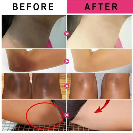 Body Whitening Cream Private Parts Underarm Bleaching Serum Whiten Butt Knee Brighten Inner Thigh Intimate Dark Remove Melanin