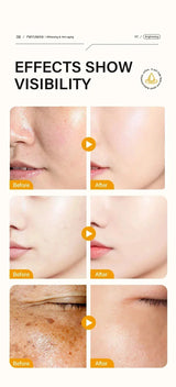 Dark Spots Remover Whitening Face Set Freckle Melanin Correcting Reduce Fine Lines Brighten Essence Korean Beauty Skin Care ﻿