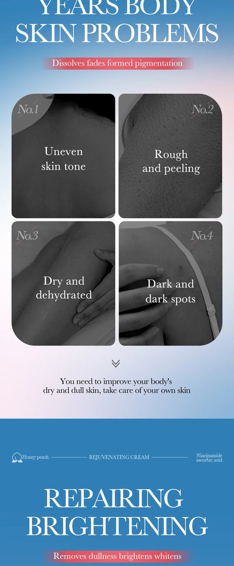 Body Care Cream Brighten Moisturizing Lotion Dull Armpit Inner Thigh Joint Skin Revitalize Uneven Skin Tone Soften Dry Sensitive