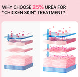 Chicken Skin Removal Cream Body Curing Keratosis Follicle Pore Spot Dull Treatment Whitening Moisturizing Body Care JoyPretty