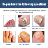 South Moon Foot Spray Anti Smell Remove Toenail Fungal Paronychia Onychomycosis Care Deodorant Antiperspirant Nail Repair Spray