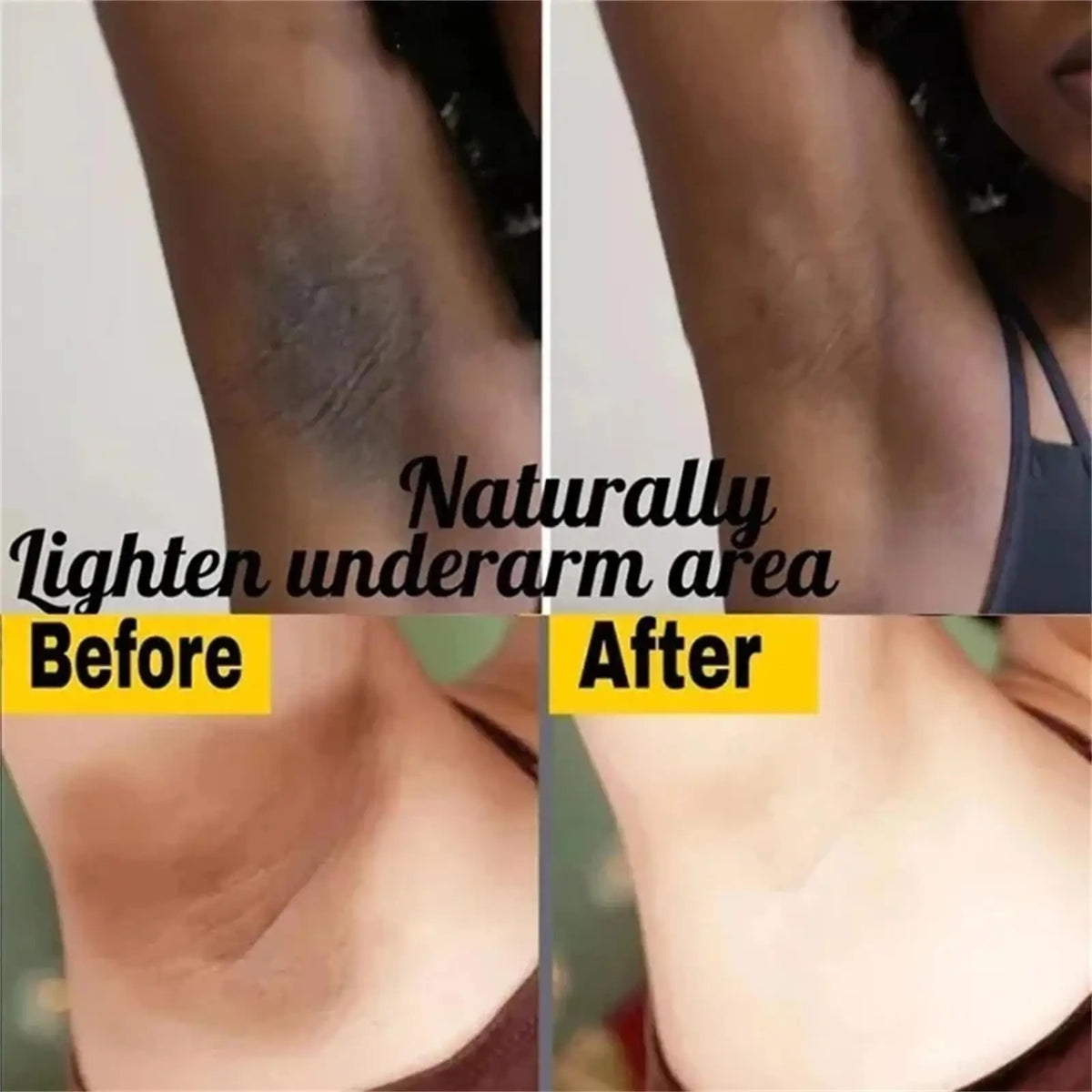 Body Whitening Cream Private Parts Underarm Bleaching Serum Whiten Butt Knee Brighten Inner Thigh Intimate Dark Remove Melanin