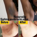 Body Whitening Cream Private Parts Underarm Bleaching Serum Whiten Butt Knee Brighten Inner Thigh Intimate Dark Remove Melanin
