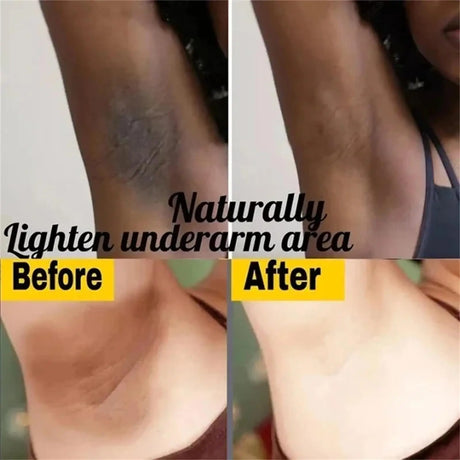 Body Whitening Cream Private Parts Underarm Bleaching Serum Whiten Butt Knee Brighten Inner Thigh Intimate Dark Remove Melanin