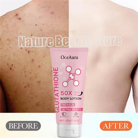 Glutathione Niacinamide Body Lotion Skin Brightening Hydrate Revitalize Even Skin Tone Whitening Face Bleaching Lightening Care