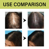 Original Amla Oil Hair Growth Moisturizing Smoothing Repair Damaged Dry Frizzy Ends Split Scalp Treatment Hair Mask Conditioner