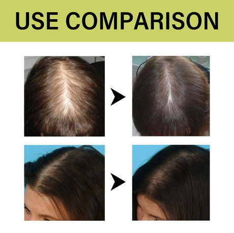 Original Amla Oil Hair Growth Moisturizing Smoothing Repair Damaged Dry Frizzy Ends Split Scalp Treatment Hair Mask Conditioner
