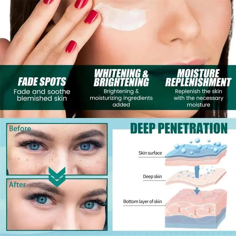 Powerful Spot-removing Whitening Freckles Cream Remove Melasma Dark Spots Fade Pigmentation Acne Moisturizing Brighten Skin Care