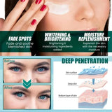 Powerful Spot-removing Whitening Freckles Cream Remove Melasma Dark Spots Fade Pigmentation Acne Moisturizing Brighten Skin Care