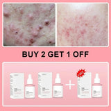 Salmon PDRN Collagen Peptide Facial Serum for Dull Skin - Boosts Elasticity Skin Renewal Repair Korean Beauty Product