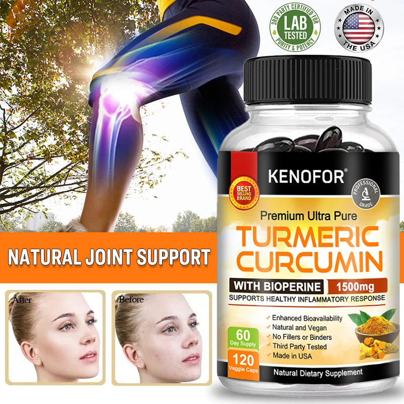 Kenofor Curcumin Antioxidant - Helps Reduce Post-exercise Inflammation and Supports Joint Health, Non-GMO, Gluten-free