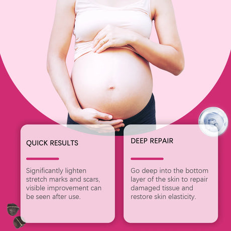 EELHOE Vitamin E Skin Care Oil Remove Pregnancy Stretch Marks Postpartum Care Elastic Skin Firming Collagen Body Care Oil 100ml